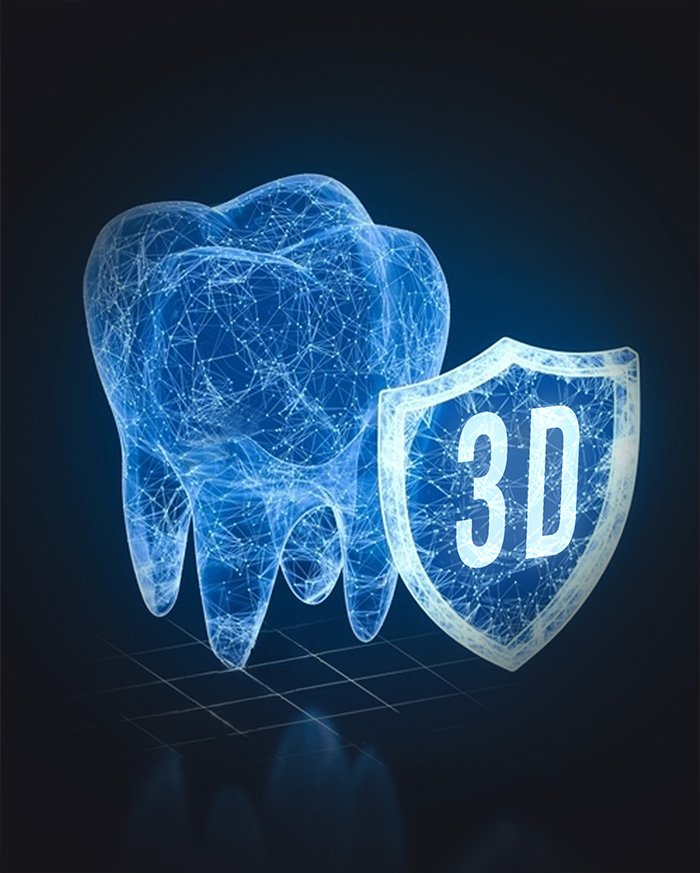 3D Kılavuzlu İmplant